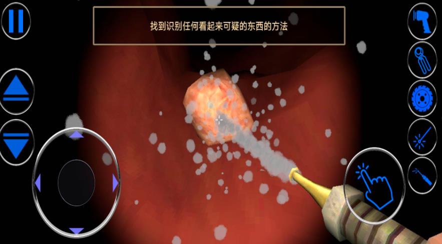 模拟肠道医生游戏安卓版图1:zcc